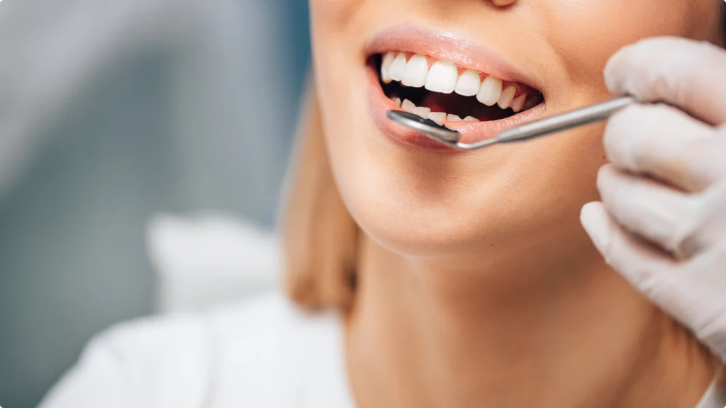 Examen dentaire au miroir chez une patiente souriante
